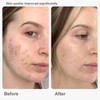 Topicals Faded Serum15ml/50ml Brightening & Clearing Serum For Dark Spots