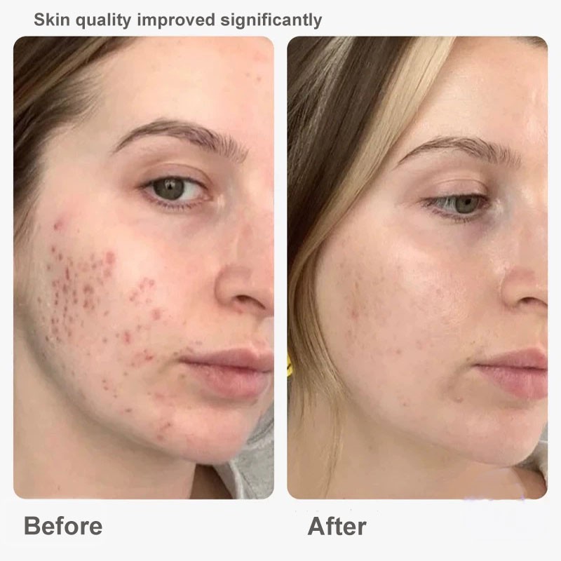 Topicals Faded Serum15ml/50ml Brightening & Clearing Serum For Dark Spots