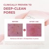 SKIN1004 Poremizing Deep Cleansing Foam, 4.23 Fl.oz, 125ml, Makeup Remover,