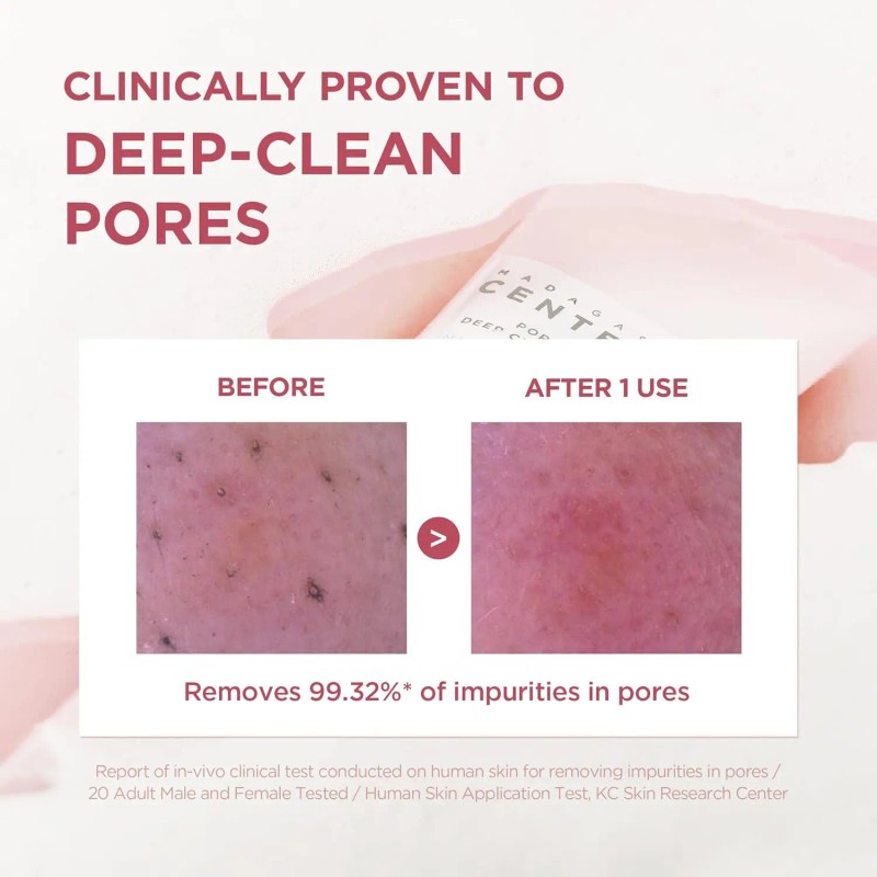 SKIN1004 Poremizing Deep Cleansing Foam, 4.23 Fl.oz, 125ml, Makeup Remover,