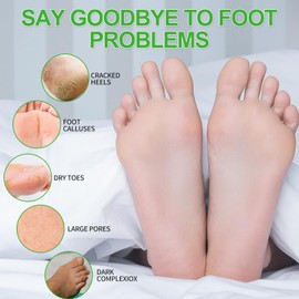 Foot Soak, Spa Pedicure Kit Lemon