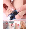1 Pair Toe Splint Broken Toe Brace Toe Straightener for