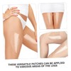 Abaodam 6pcs Transparent Chafing Thigh Stickers Durable Invisible Protection for