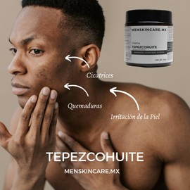100gr Crema de Tepezcohuite - Fórmula Natural para la Regeneración Cutánea, Cicatrices y Marcas - Nutre, Hidrata y Restaura tu Piel para una Apariencia Saludable y Renovada, Sin Parabenos ni Ingredientes Nocivos - "Descubre el Poder del Tepezcohuite para