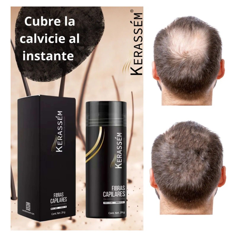 Fibras Capilares 29g Cubre Calvicie Kerassém Tonos