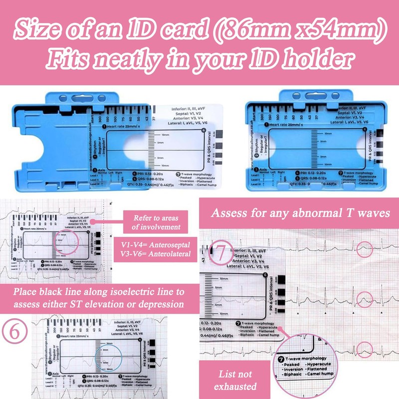 Ecg 7 Step Ruler, Ecg/Ekg 7 Step Ruler Card, Portable