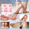 Urea 60% Foot Cream Stick Foot Care Cream for Cracked