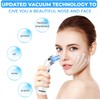 Senelux Blackhead Remover Vacuum Pore Cleaner Acne Comedone Extractor Face