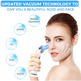 Senelux Blackhead Remover Vacuum Pore Cleaner Acne Comedone Extractor Face Pore Vacuum Blackhead Remover Tool Facial Pore Cleanser with 5 Adjustable Suction Power and 4 Replacement Probes