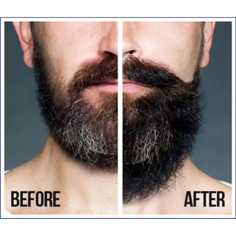 Aceite Para Hacer Crecer La Barba Y Bigote Rapido Natural