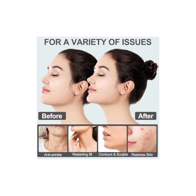 3 PCS Faja Papada, Lifting de Cara Correa, Correa Adelgazante
