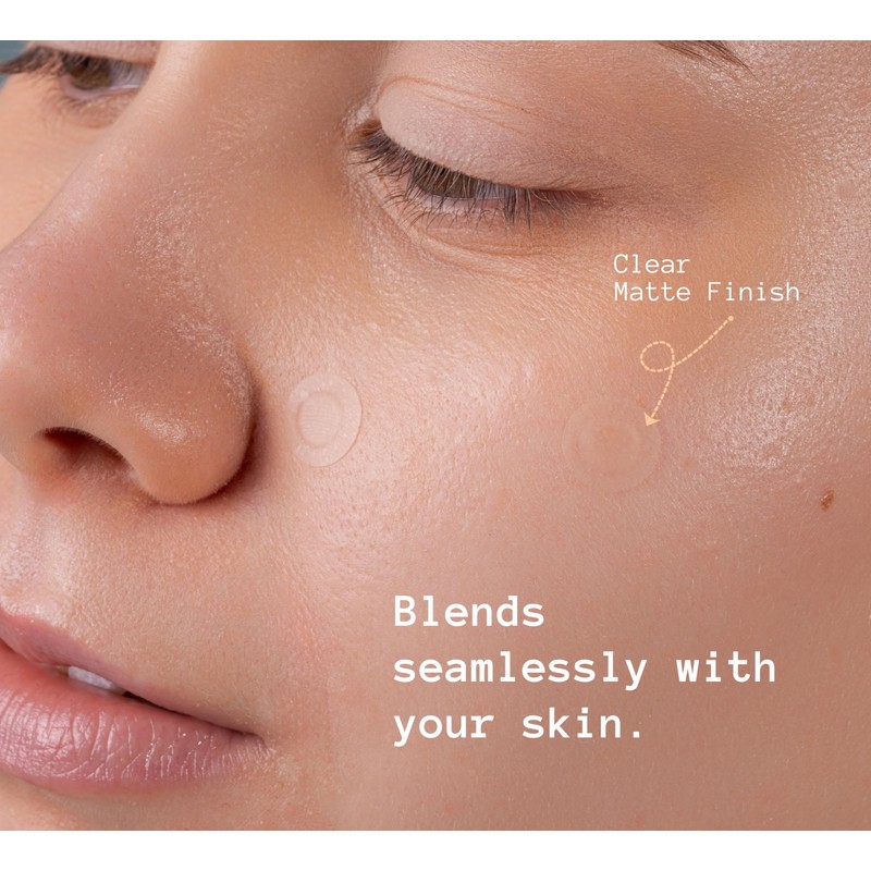Anva Korean Spot Patches with Salicylic Acid - Ultra-thin Blemish