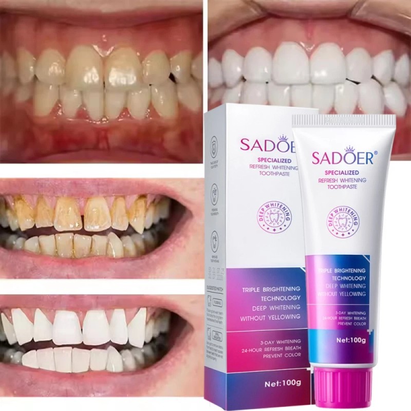 SADOER Purple Toothpaste for Teeth Whitening - Tooth Stain Removal,Purple
