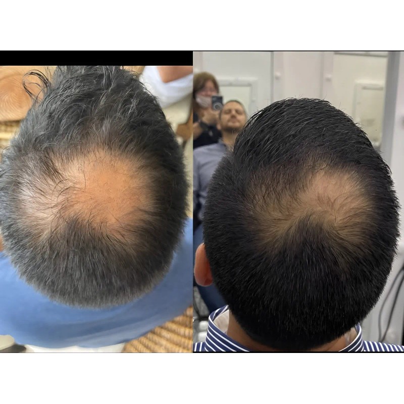 Shampoo Reviving Farmasi Caida Cabello