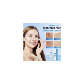 HANYWIL-Dark Spot Remover.Face Body,Dark Spot Corector Cream,Skin Brown Spot-2oz