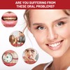 Sp10 Probiotic Toothpaste, 2PCS 100g Sp-10 Ultra Whitening Toothpaste, Deep