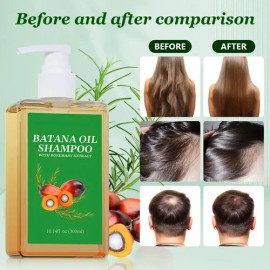 Champú De Aceite De Batana Para El Crecimiento Del Cabello,                                                                                           