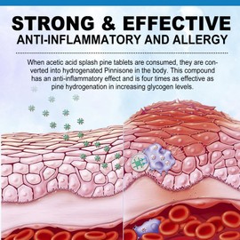 Itchy Dog Skin Relief, Anti Itch and Immunity Treats for Dogs, Anti Itch for Dogs, Dog Allergy Relief, w/Omega 3 + Pumpkin + Enzymes, Seasonal Allergies, Hot Spots, Peking Duck Flavor 150 Treats