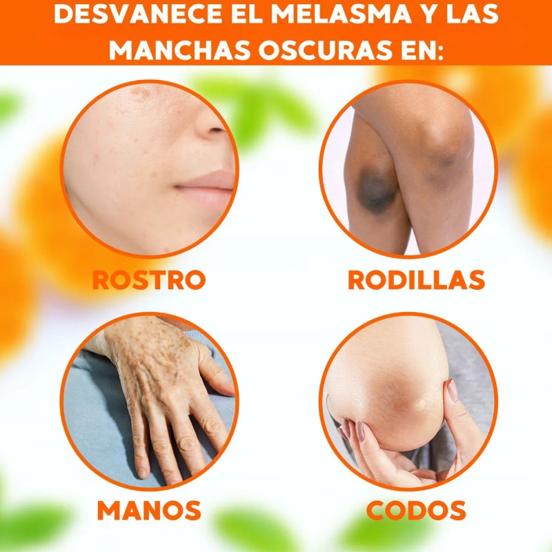 Serum Despigmentante Con Vitamina C Alfa Arbutina Neoprosone Todo Tipo