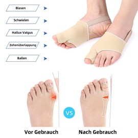 Eurtes Pack of 6 Hallux Valgus Toe Separators with Bunion Protection, Correction Bandage Socks Bunion Corrector with Non-Slip Belt and Gel Pads for Valgus Bunion (Pack of 6)