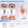 3-in-1 Cellulite Massage - Body Sculpting Machine Home Use Cupping