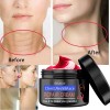 Eelhoe Crema Antiedad Para Rostro Cuello y Pecho Elimina Manchas