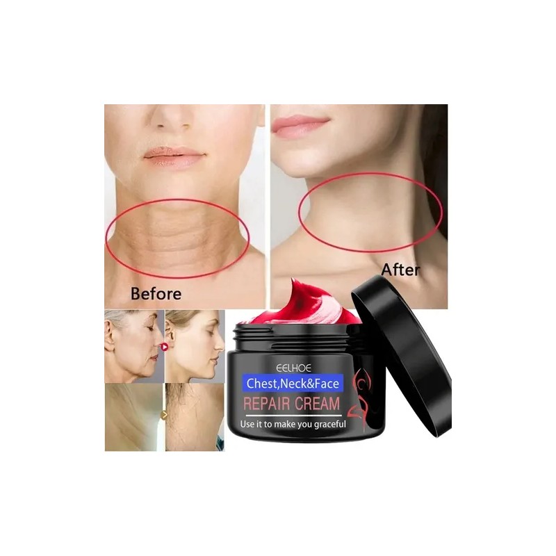 Eelhoe Crema Antiedad Para Rostro Cuello y Pecho Elimina Manchas