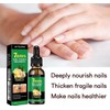 JAYSUING 【Buy 1 Get 1 Free】JAYSUING Ginger Nail CareSerum, Moisturizes,