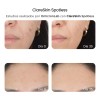Reve Clareskin Spotless Suero Facial Despigmentante 30ml