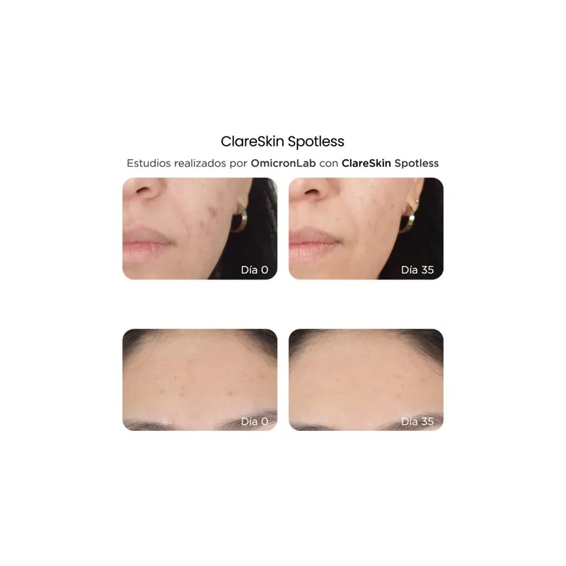 Reve Clareskin Spotless Suero Facial Despigmentante 30ml