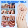 Parches Para Uñas Fúngicos 63pzs Caja De Parches Dañadas