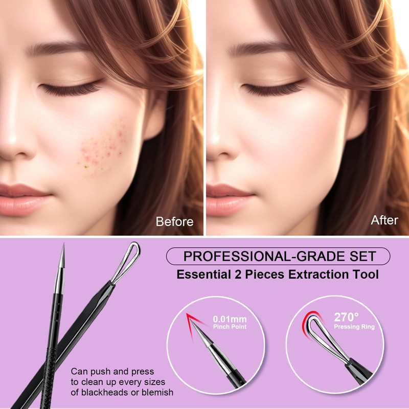 Teenitor Pimple Extractor Tool Comedone Extractor Acne Tool Blackhead Removal
