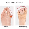 Bunion Corrector, Adjustable Big Toe and Tail Toe Separator Orthopedic