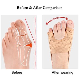 Bunion Corrector, Adjustable Big Toe and Tail Toe Separator Orthopedic Bunion Splint Brace, Hammer Toe Straightener Bunion Relief, Breathable Bunion Socks Sleeves for Women Men, Day Night Support (S)