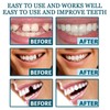 EELHOE Snap On Veneers Dentures Fake Teeth Set, Temporary Veneers