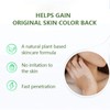 NYYQYYN Vitiligo Treatment Cream, Natural Mild Restore (1pcs)