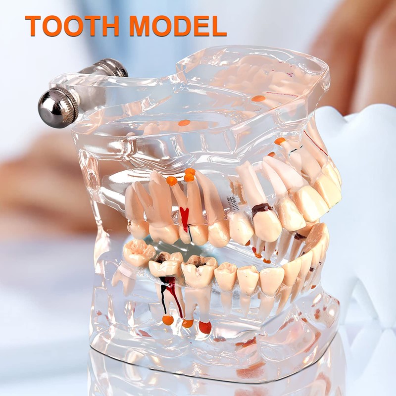 Standard Dental Model for Dentistry Students, Standard Study Teaching Dental