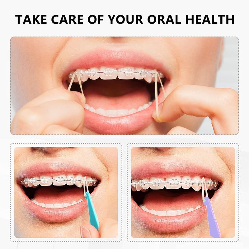 Orthodontic Elastic Disposable Plastic Braces for Braces Orthodontic Elastic Placer