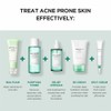 SKIN1004 [SKIN1004]Madagascar Centella Tea-Trica Spot Cream 20ml