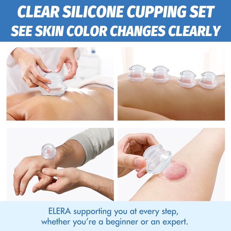 ELERA Silicone Cupping Therapy Set, Professionally Chinese Massage Cups for