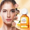 Sérum De Vitamina C: Cuidado Facial Hidratante: Ilumina La P