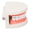 Dental Disease Caries Teeth Model Resin Simulation Teaching Prop Dental