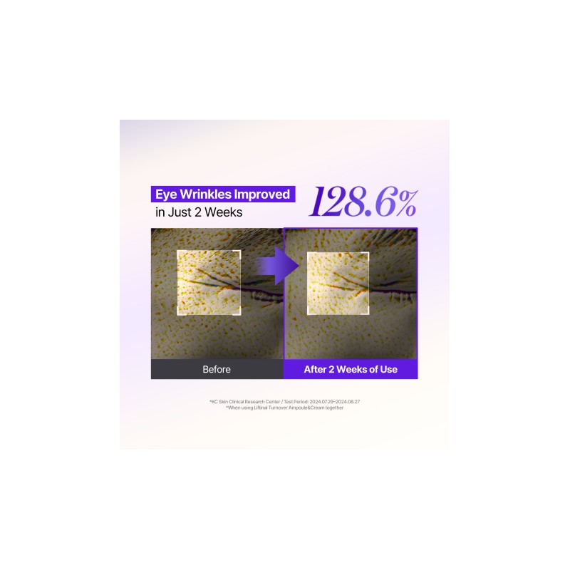 MILDLAB [MILDLAB]5 EGF Retinal Liftinal Turnover Ampoule 30ml