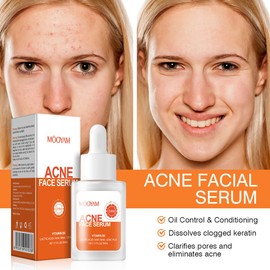 Salicylic Acid Face Serum with BHA & AHA - Blackhead Remover, Pore Refiner - For Acne Prone, Oily & Combination Skin - Gently Helps Clear Clogged Pores - Skin Care for Men & Women 30 ML