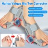 2PCS Hallux Valgus Bunion Corrector Orthopedic Adjuster Brace Foot Toe