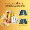 50 Megumi Anti-Hair Loss Treatment Essence 30ml