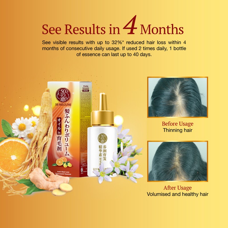 50 Megumi Anti-Hair Loss Treatment Essence 30ml