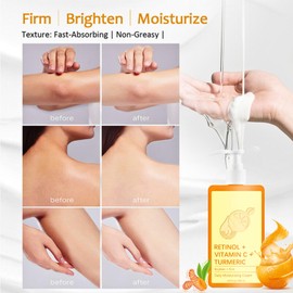 Vitamin C Cream, Vitamin C Body Lotion, Vitamin C Body Cream, Large-capacity Body Moisturiser With Vitamin C, Turmeric And Retinol, Vitamin C Dry Skin Moisturiser, Body Skin Care Smooth Skin, 200ml