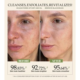 Revitalizing Exfoliation Face Scrub with Vitamin C and Turmeric – Gentle Exfoliating Face Wash for Blackheads, Pore Dirt & Dark Spots – Acne Control Facial Scrub for Oily & Acne-Prone Skin, 4.23 Fl Oz