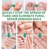 Ginger Nail, Tratamiento de Uñas con Jengibre, Soporte para Uñas